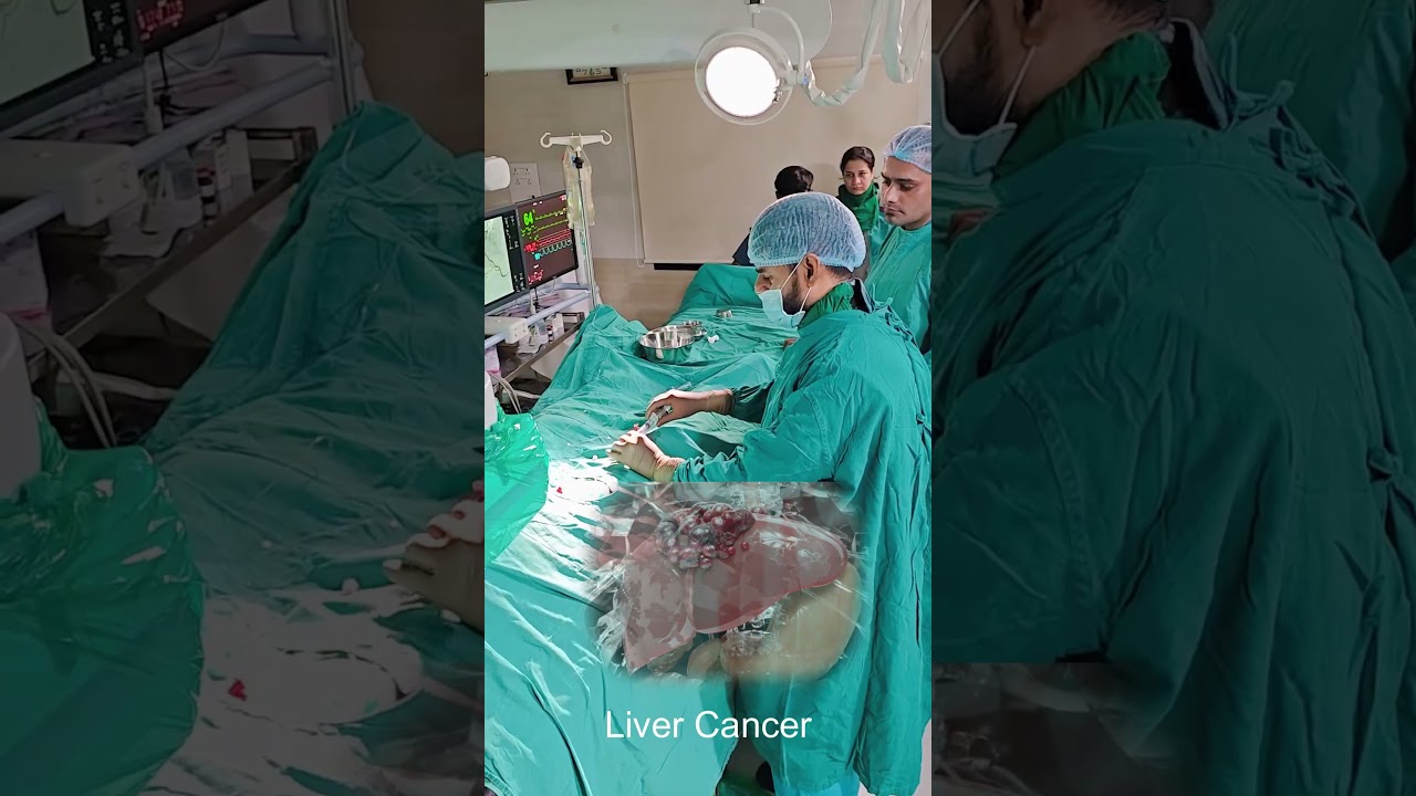 Liver Cancer Treatment | What is TACE? | Minimally Invasive Cancer Care