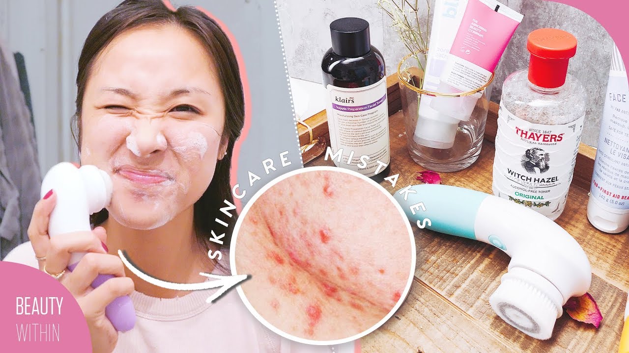9 Skincare MISTAKES That Can Make ACNE & Large PORES Worse! (Ft. Wishtrend TV)