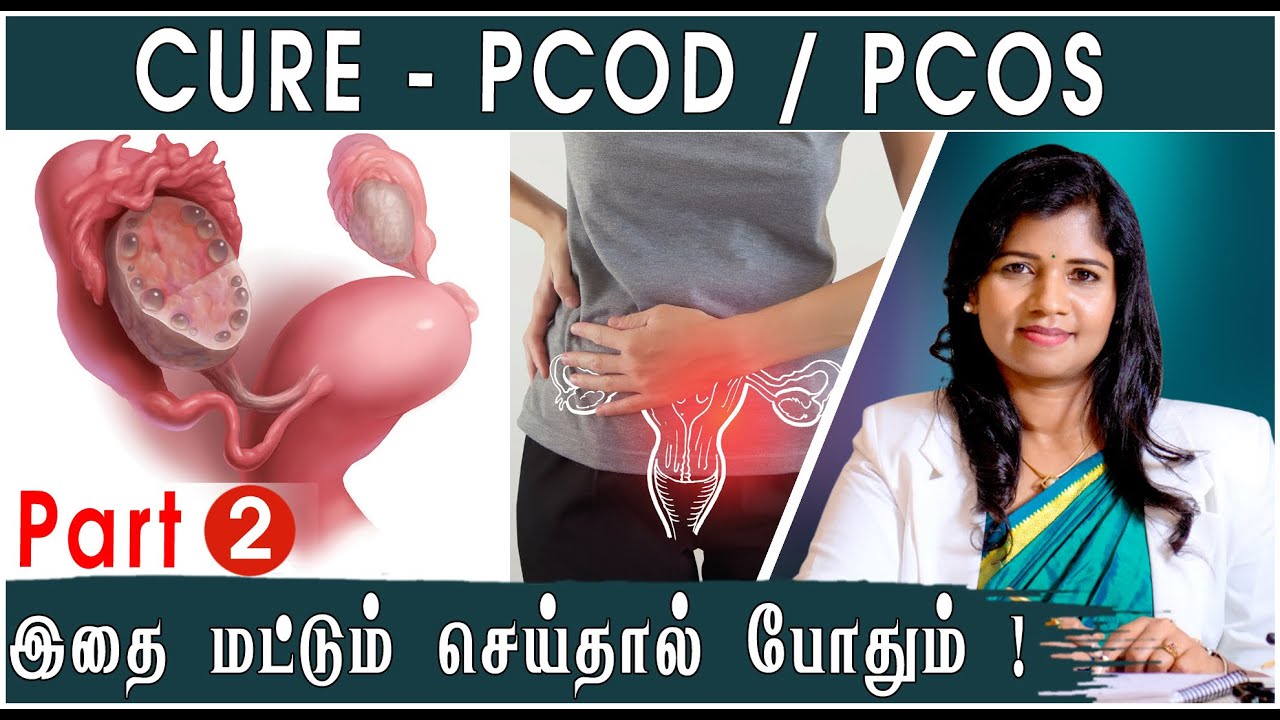 Part - 2 | நீர்கட்டியை நிரந்தரமாக சரி செய்ய ! | Natural Methods To Cure PCOS | PCOD | Dr.Yoga Vidhya