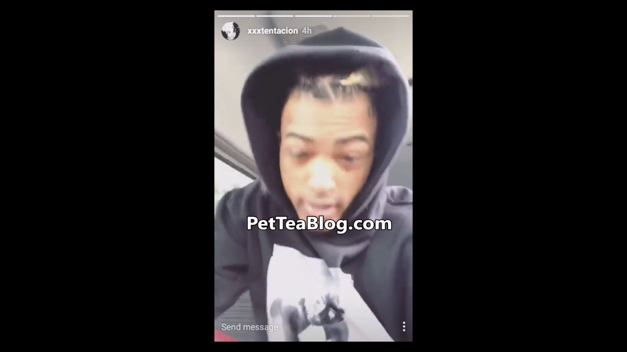 XxXTentacion is Happy he got KNOCKED out👊🙂 #xxxtentacion #petteablog