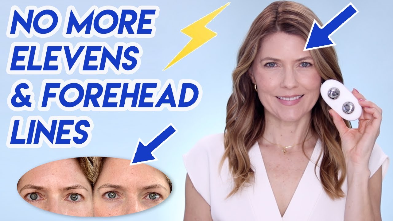 Collagen Banking: Smooth Forehead Lines & Elevens & Prevent Wrinkles Naturally with the ZIIP Halo