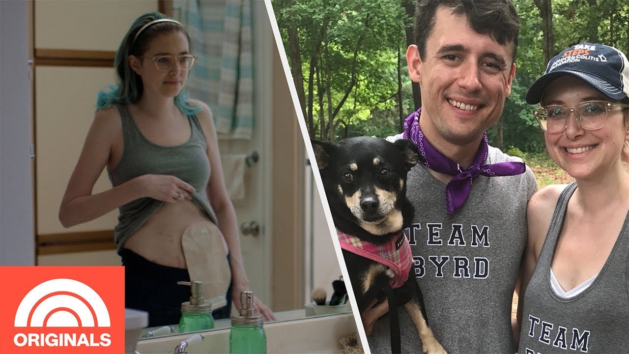 Woman Gets Colon Removed After Crohn’s Disease Worsens | Today