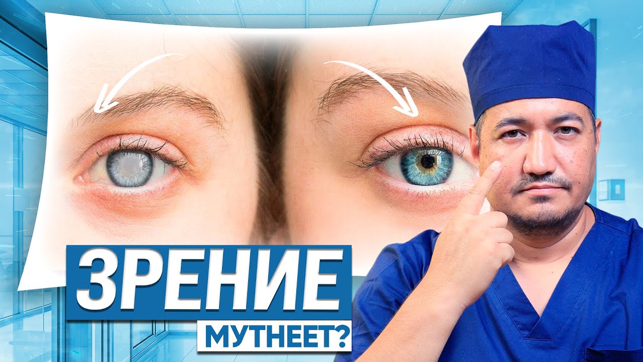 Катаракта: почему зрение мутнеет и почему нельзя откладывать операцию