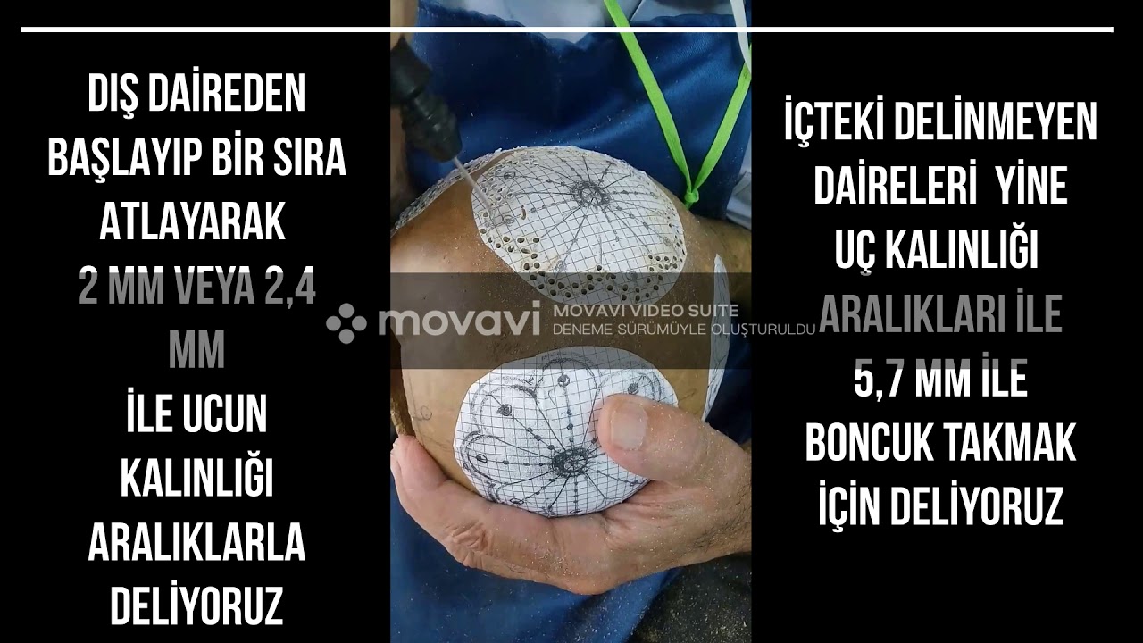 DERS 1