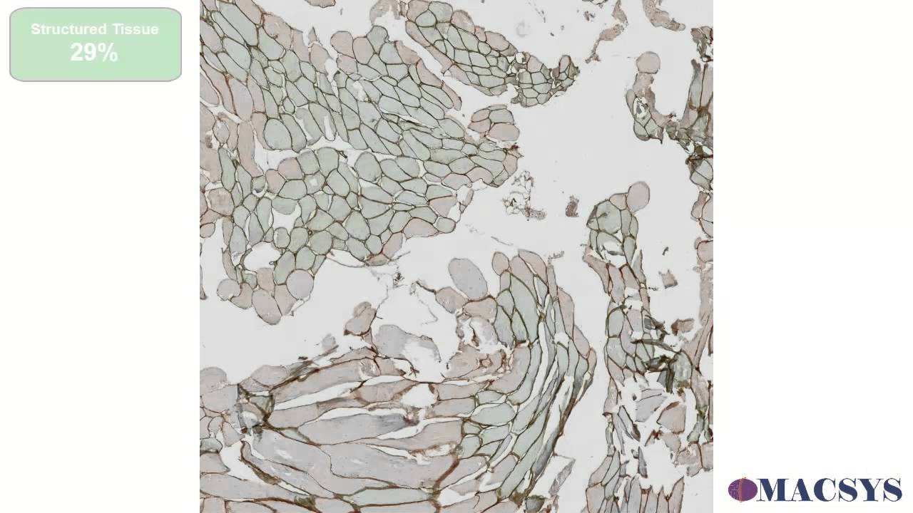 MACSYS project &ndash; Automatic Image Analysis