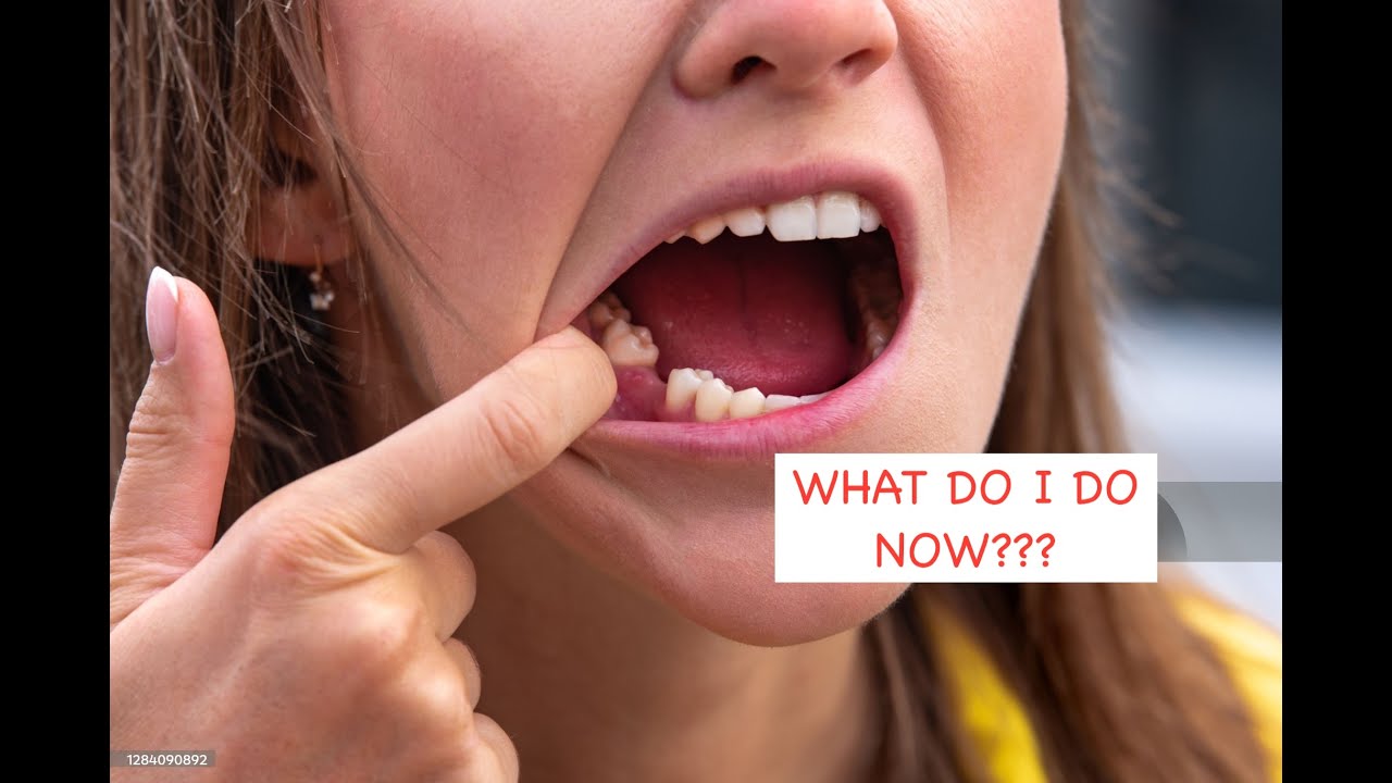 What options do I have to replace my missing tooth??