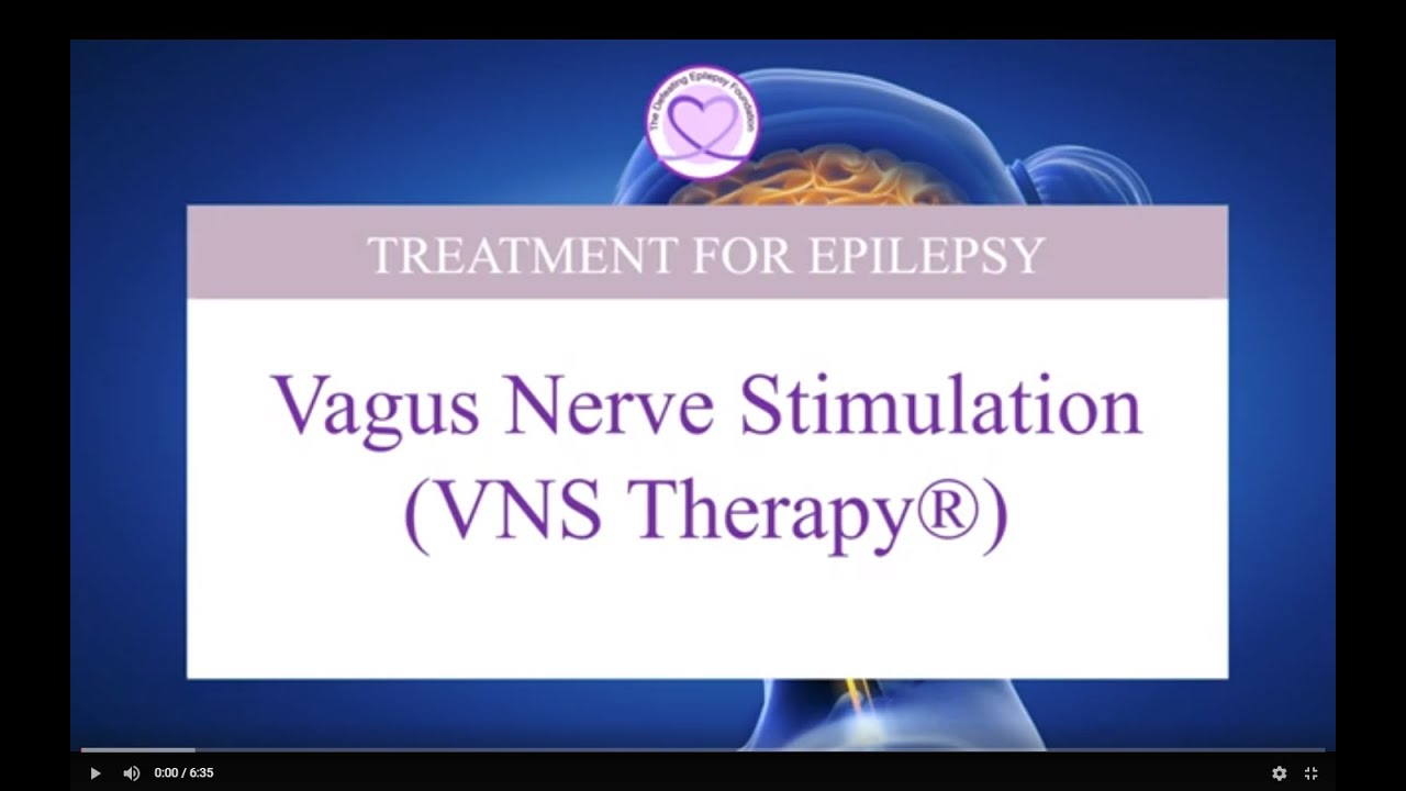 Vagus Nerve Stimulation