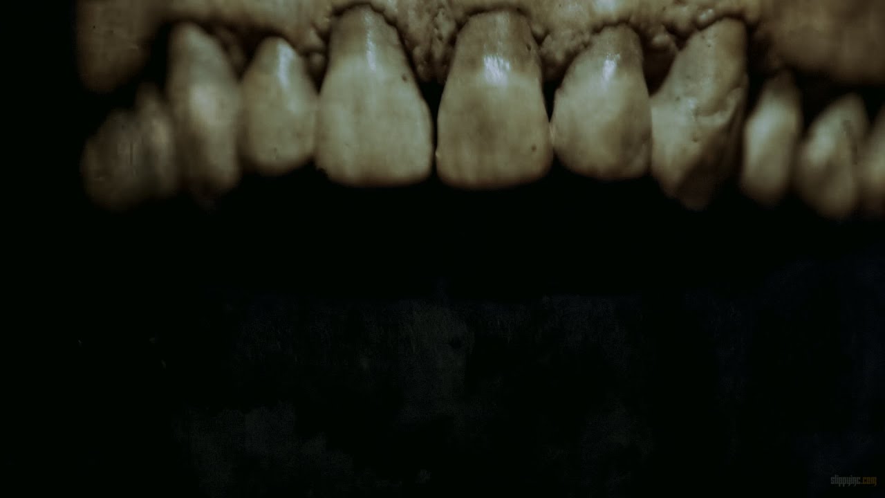 SCHIZOGEN - BIOLOGICAL DAMAGE PROCESSES [OFFICIAL MUSIC VIDEO] (2020) SW EXCLUSIVE