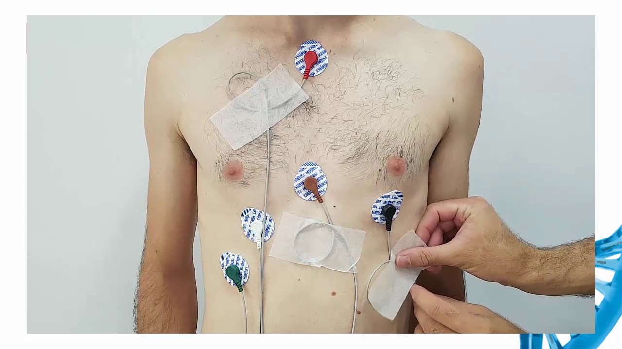 Instruções para exame de Holter Nomad