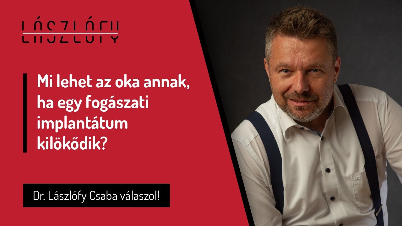 Mi lehet az oka annak, ha egy fogászati implantátum kilökődik, illetve nem épül be a csontba?