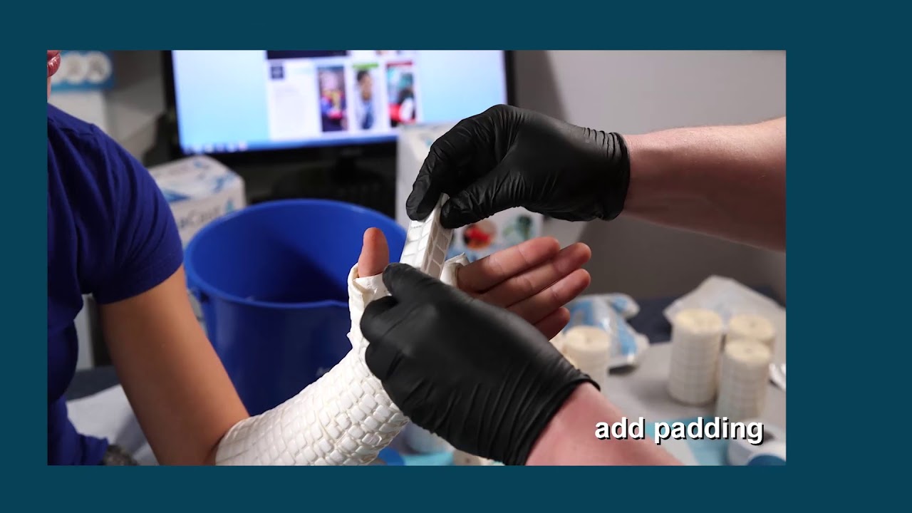 AquaCast Liner Thumb Spica Cast Application