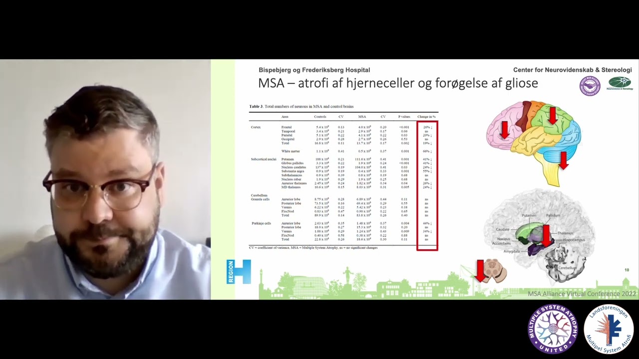 Alpha-synuclein og Immun Responset i Multipel System Atrofi - Jonas Folke, PhD