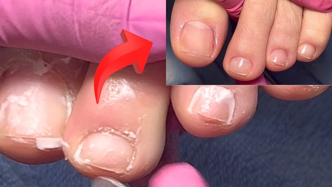 Vejam como eu faço a cutílagem e não percam as dicas infalíveis!