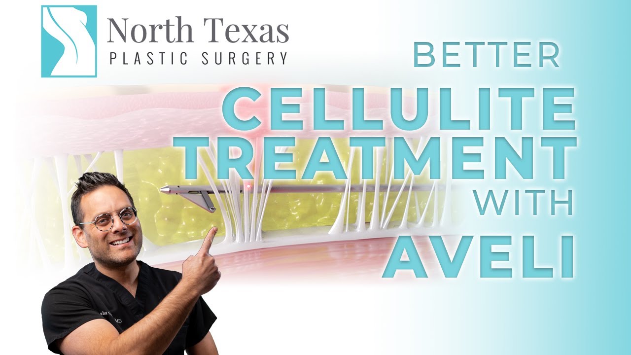 Understanding Cellulite's Root Cause Is REALLY Important