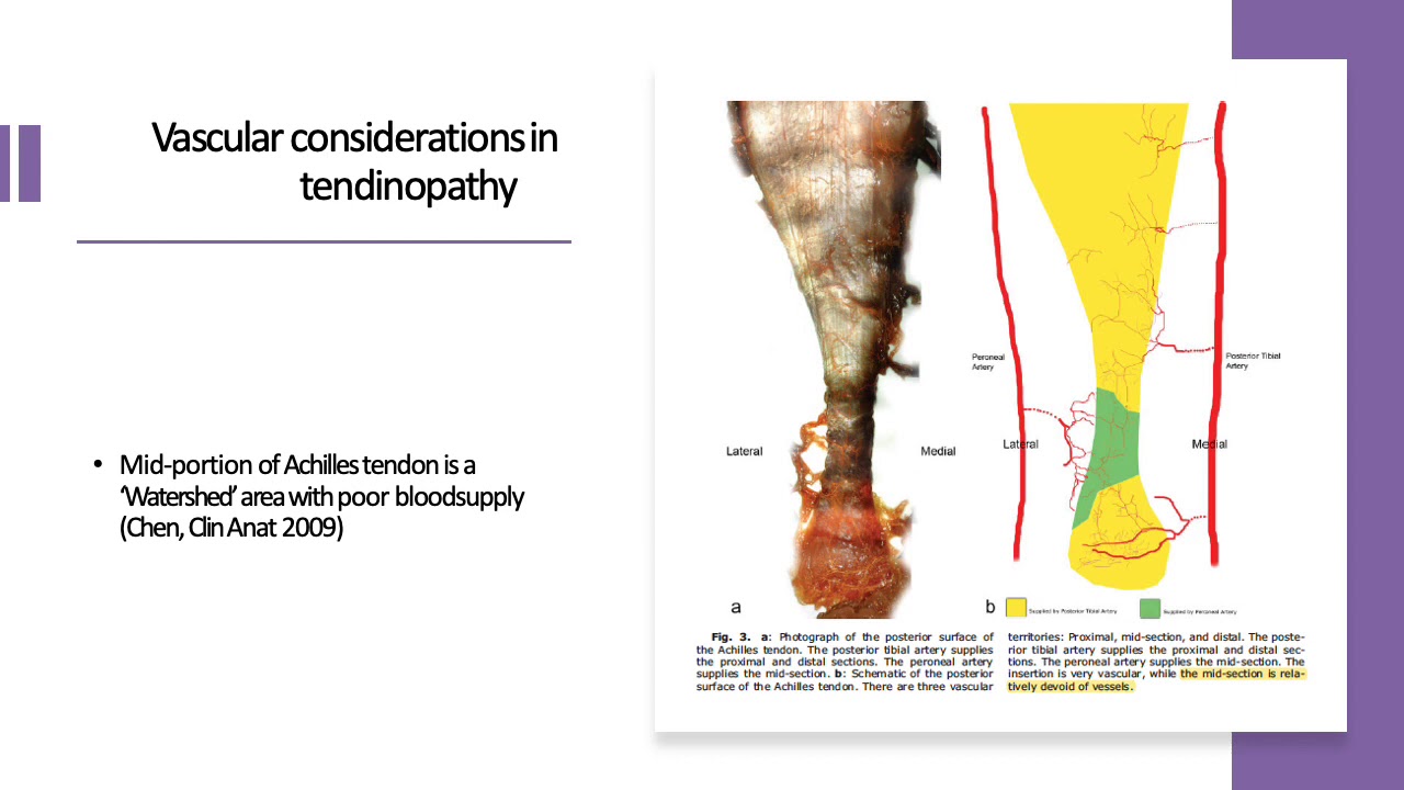 Update on tendinopathy