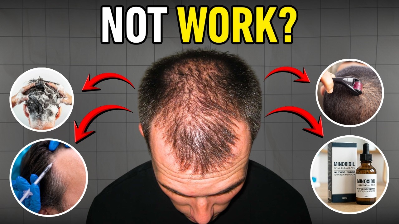 Why 90% Hair Loss Treatments Fail | Scientific Guide 2026 | Real Solution by Dr. Vivek Galani