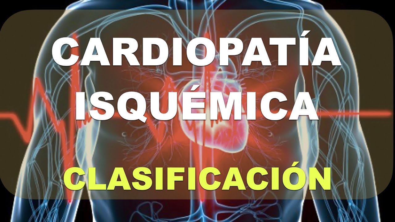 Cardiopatía Isquémica: Crónica vs Aguda. Fisiopatología