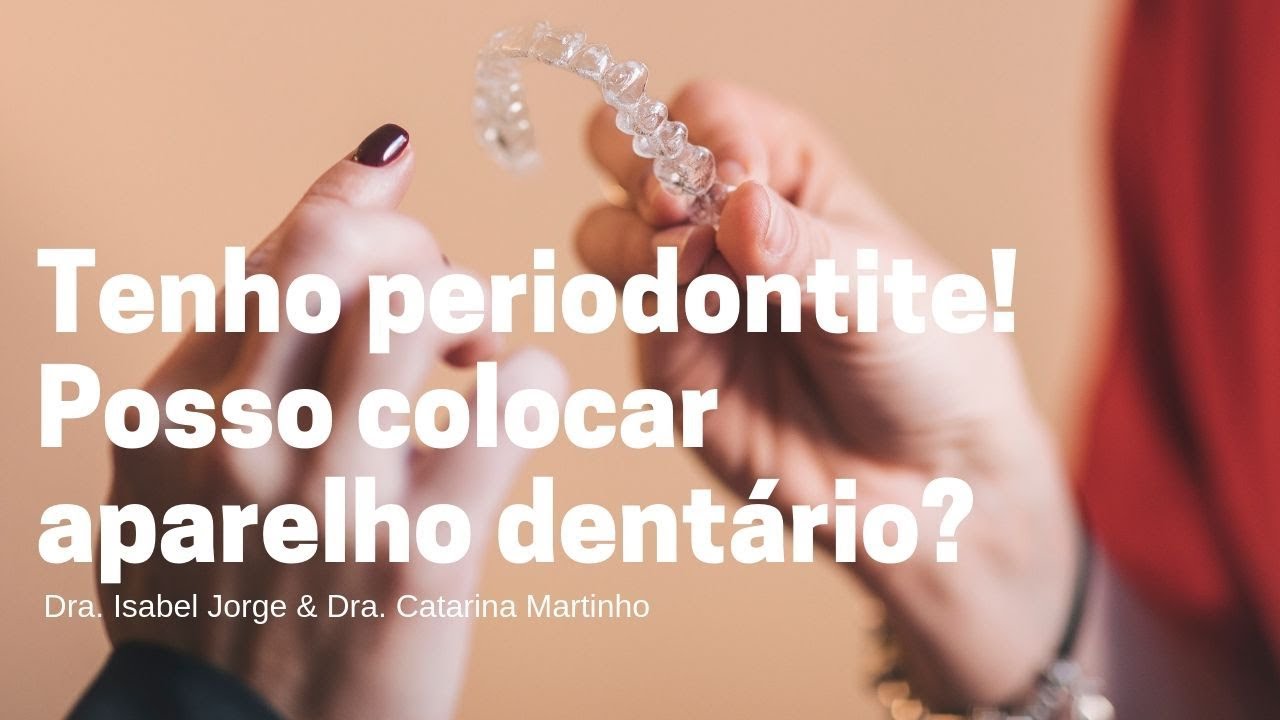 Aparelho dentário e periodontite? — Dra. Catarina e Dra. Isabel | Clínica Hugo Madeira