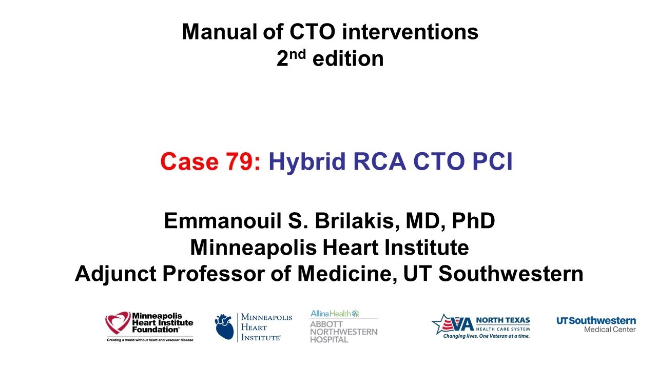 Case 79: Manual of CTO Interventions - Hybrid RCA CTO PCI