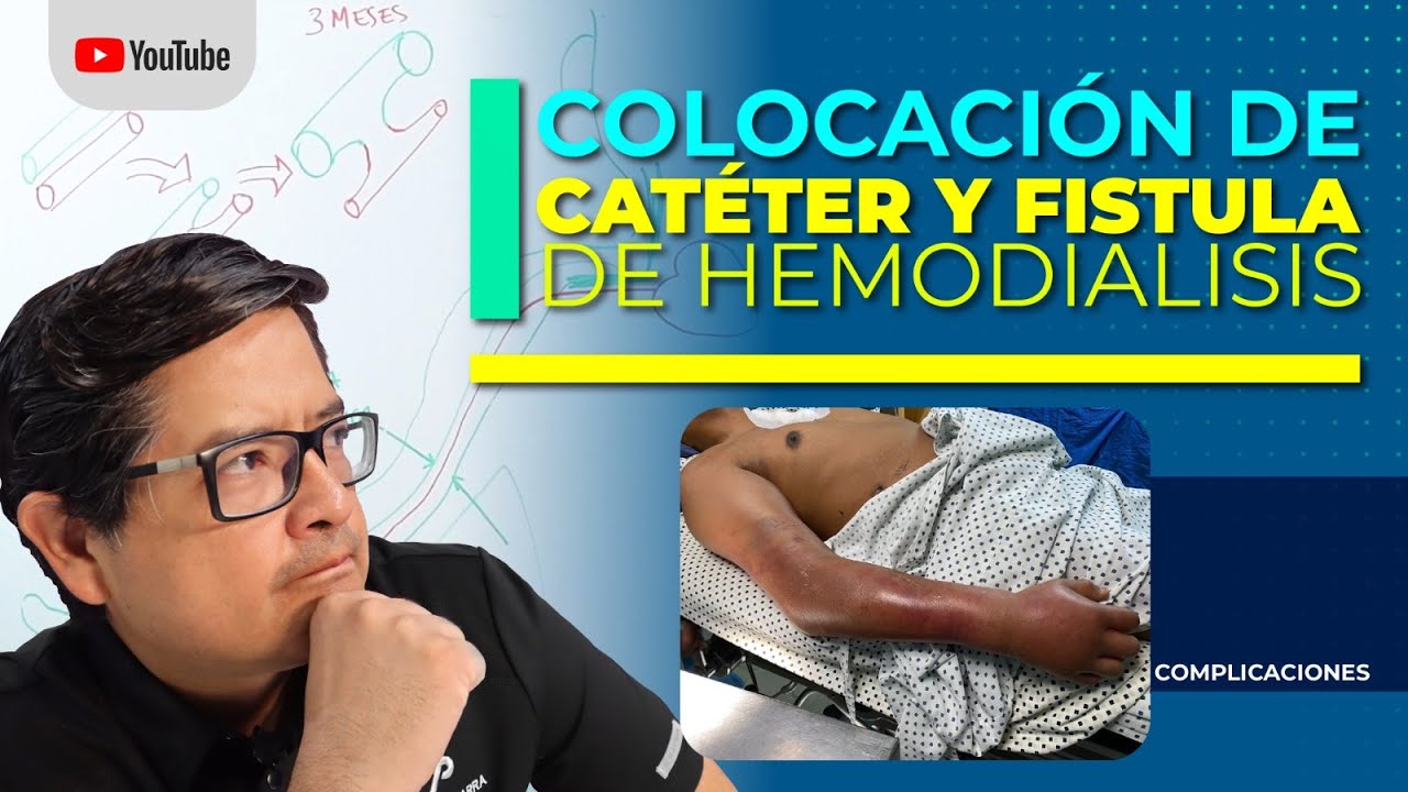 REVELANDO EL MISTERIO‼️ ¿Por qué los Catéteres de Hemodiálisis no se Colocan Abajo de la Clavícula?