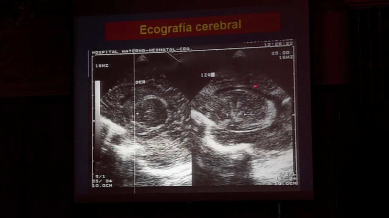 Citomegalovirus: dificultades en el diagnóstico y oportunidades de tratamiento – Dra. Liliana Asís