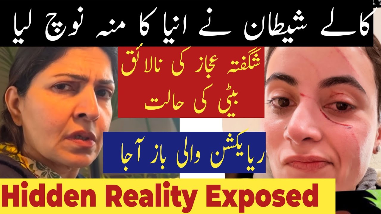 Anya Ali Hamza Face in Critical Condition|| Reality Exposed🔥