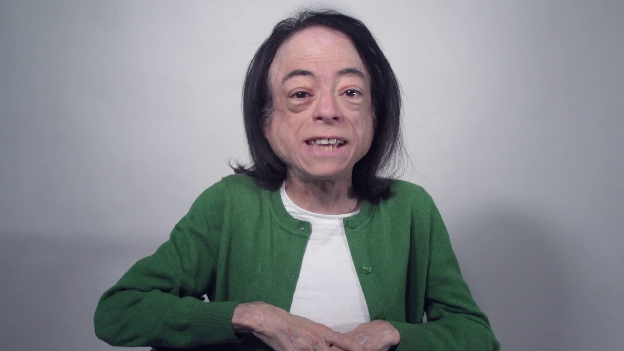 Touretteshero's Urgent Christmas Appeal With Television's Liz Carr