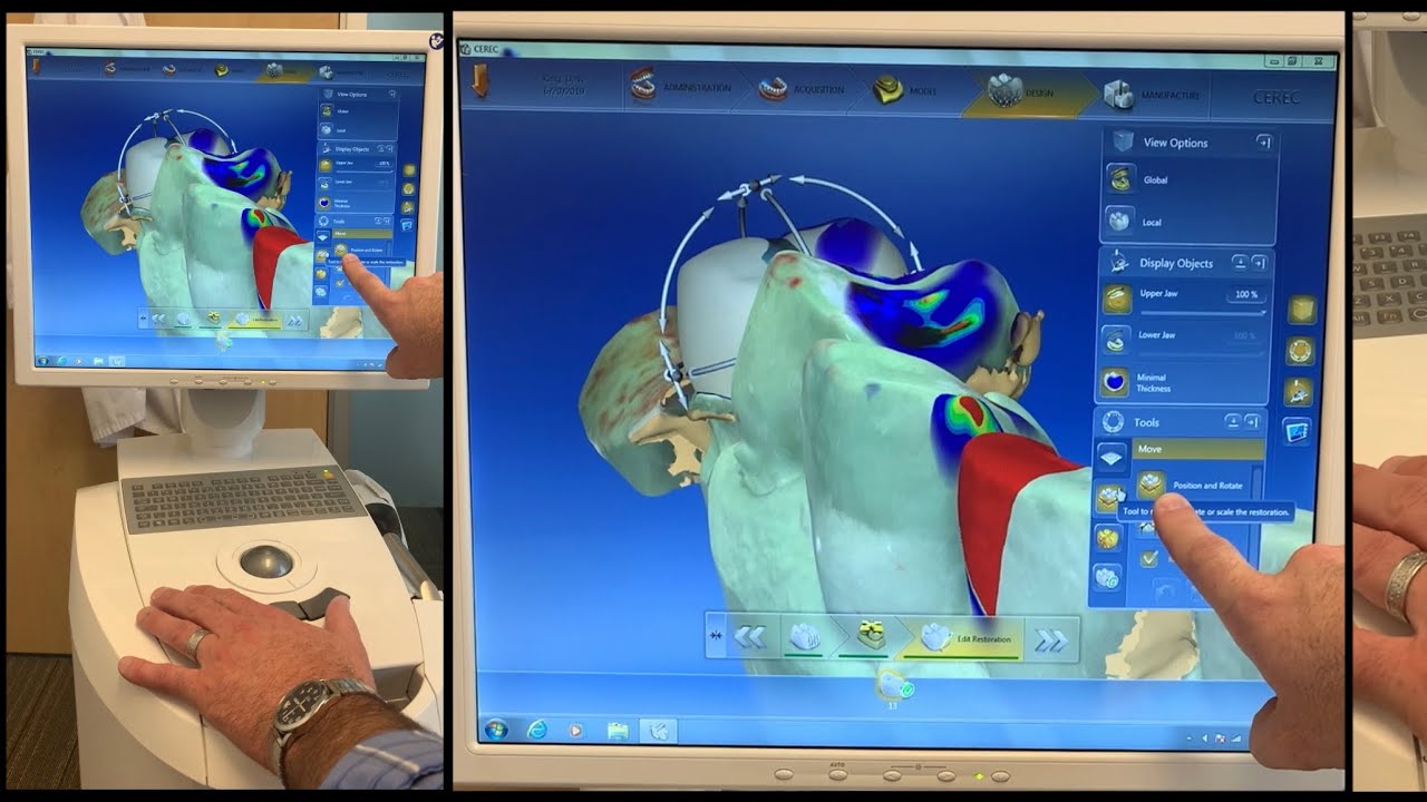 CEREC Dental Assistant Training Basics - Single Crown Setup, Imaging, Design - Overview