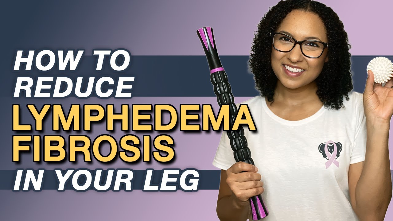 Lymphedema Treatment: How to Reduce Leg Fibrosis | Lymphedema Management