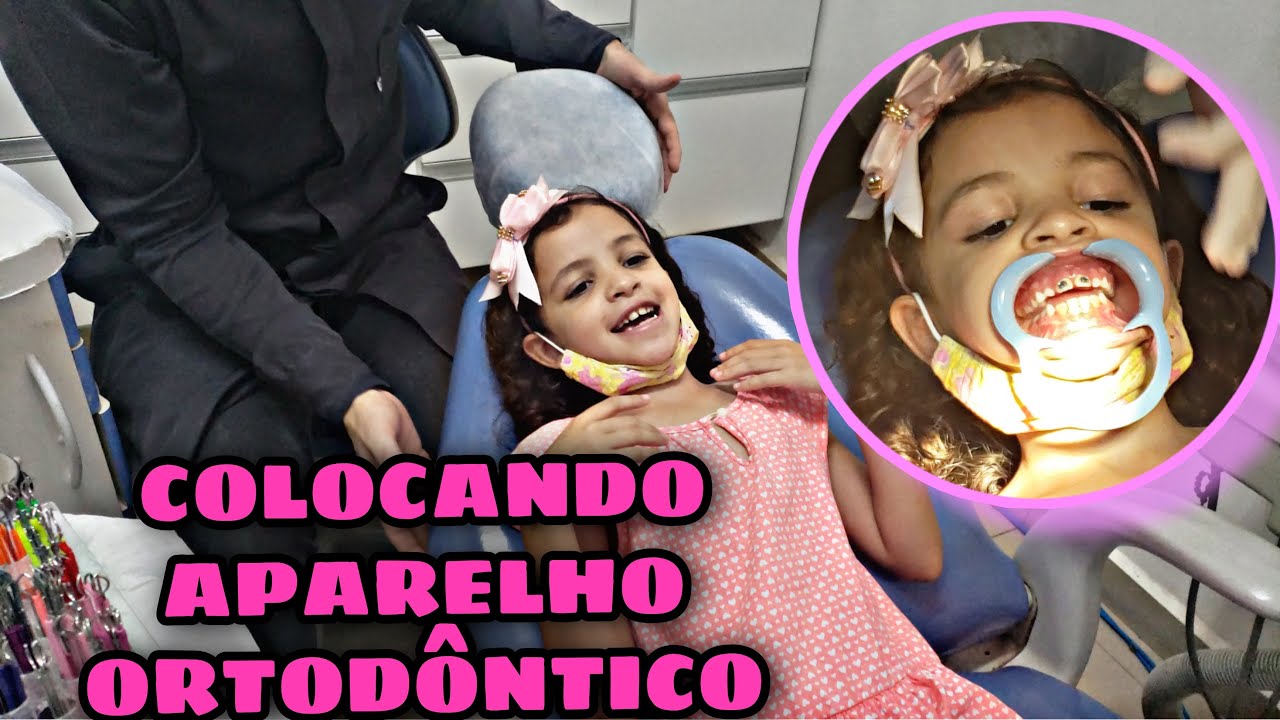 COLOCANDO APARELHO ORTODÔNTICO AOS 7 ANOS