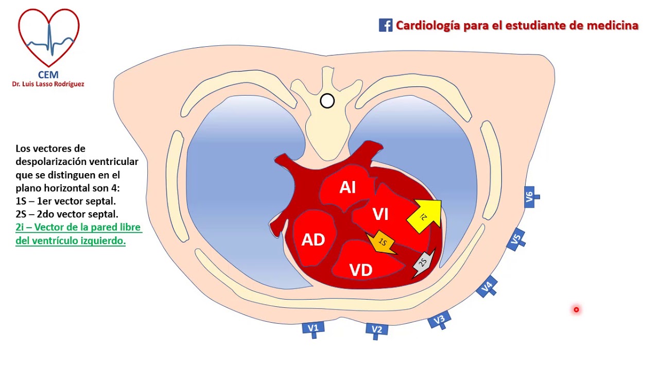 Derivaciones precordiales