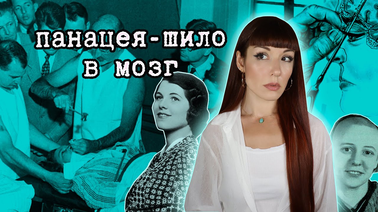 ЛОБОТОМИЯ, которую сделали даже сестре президента... Истории пациентов доктора Фримена.