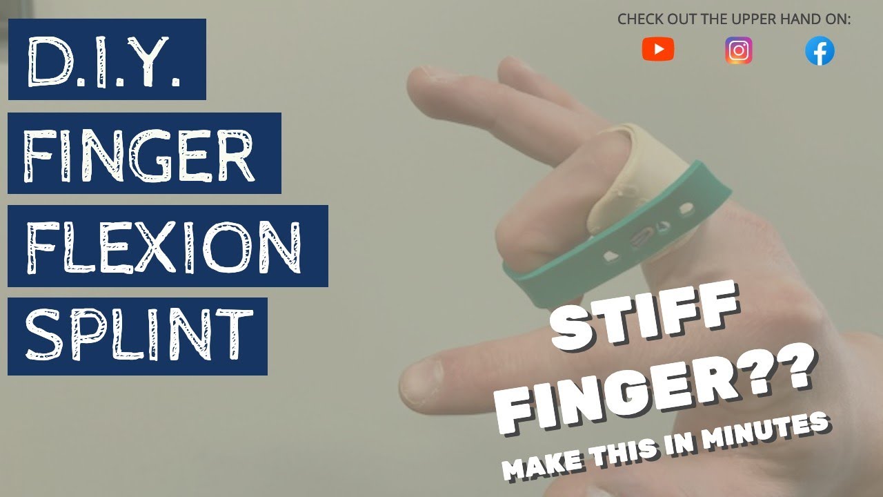 How to Fabricate a Custom Orthosis/Splint For Prolonged IP Flexion