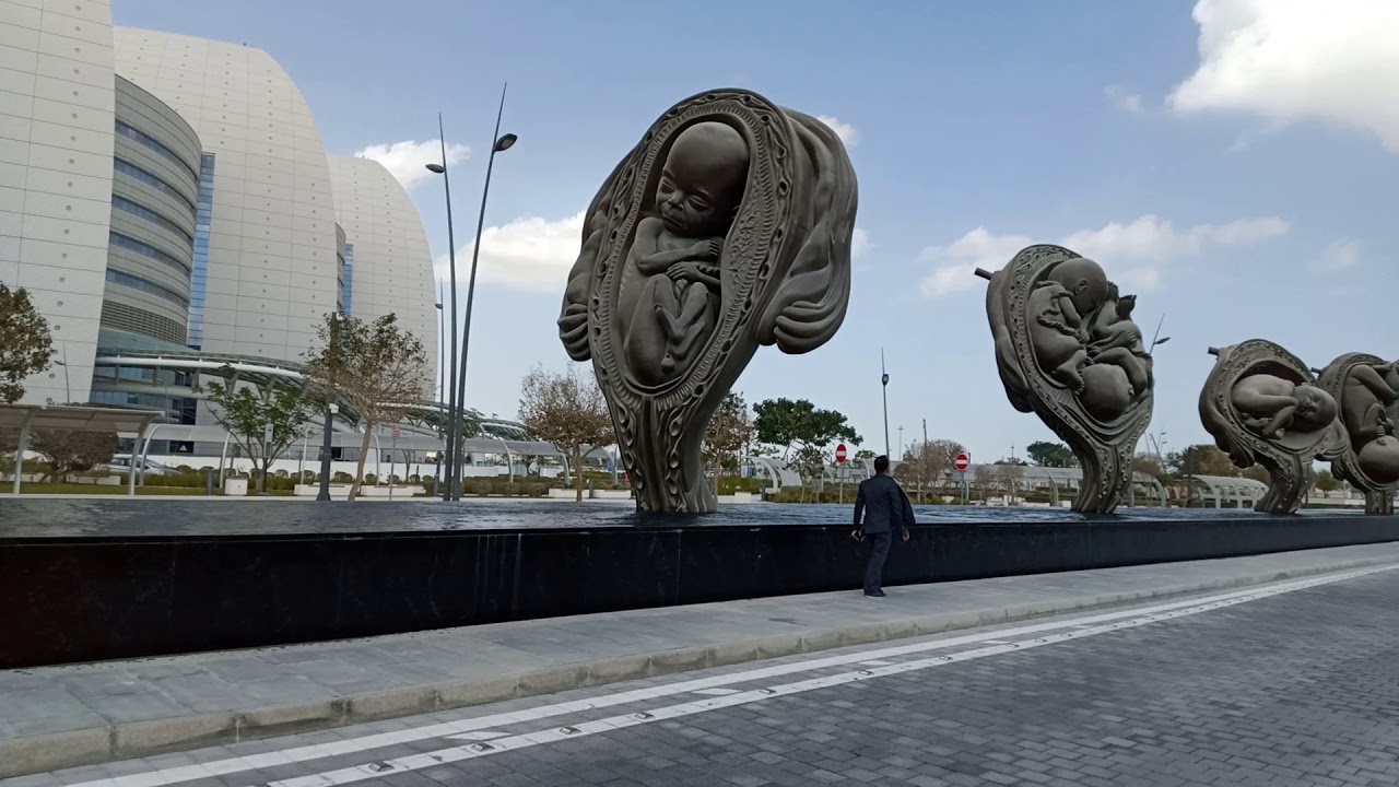 Sidra hospital qatar