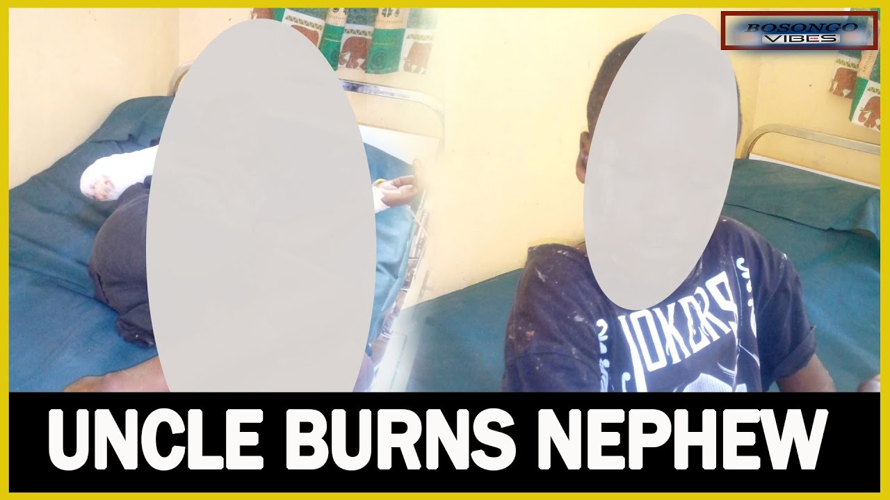 Kisii: Rogue uncle severely burns hungry grade 5 nephew for eating a ripe Banana