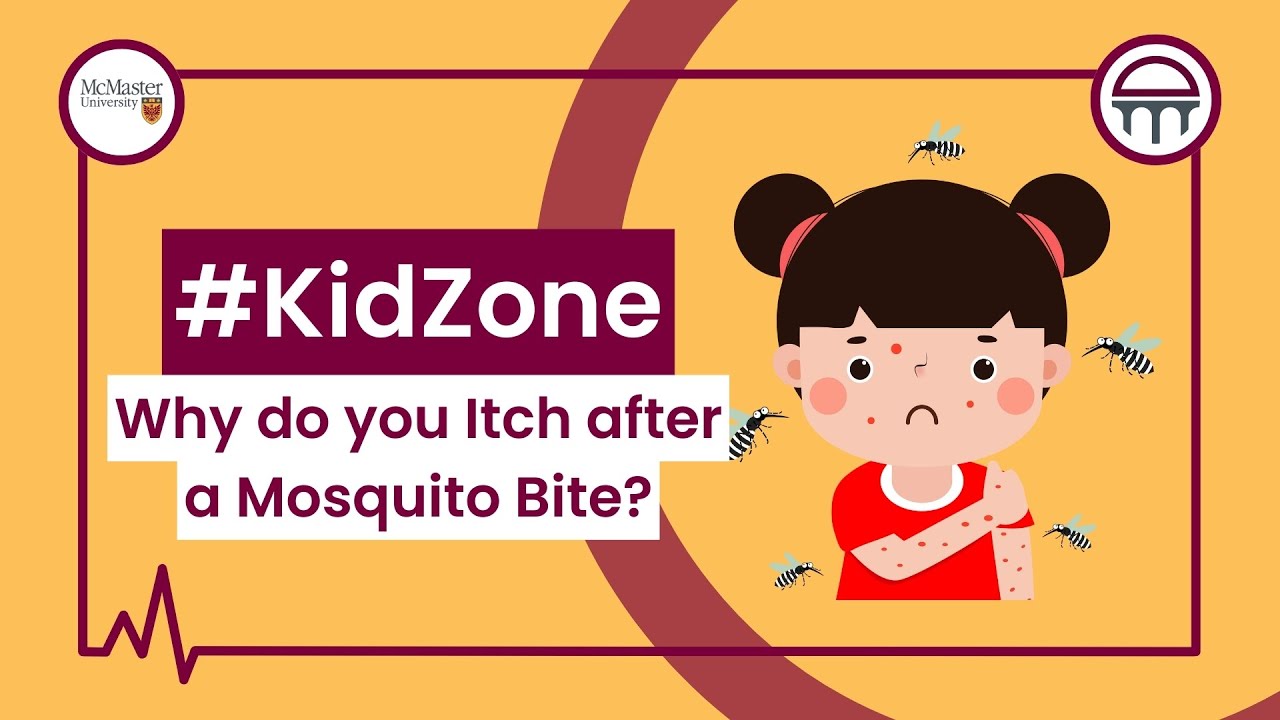 #KidZone - Why do you Itch after a Mosquito Bite?