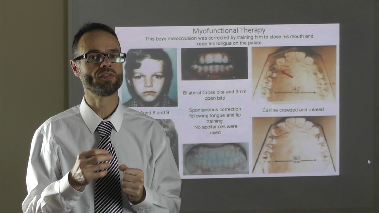 Myofunctional Therapy By Dr Mike Mew