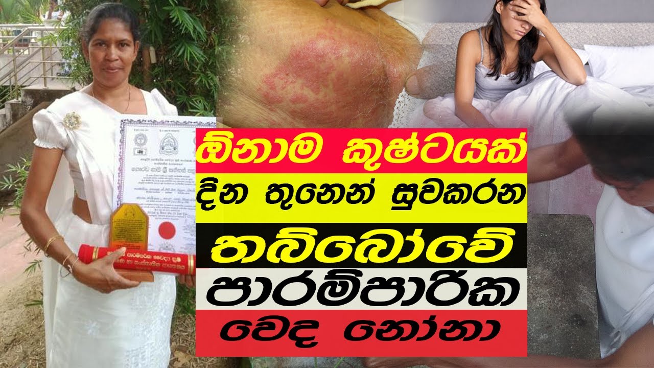Hela Osu-   hela vedakama-රහස් ප්&zwj;රදේශයේ හා දද කුෂ්ට දින 03 සුවකරන  තබ්බෝව වෙද නෝනා      #Sl tv1st