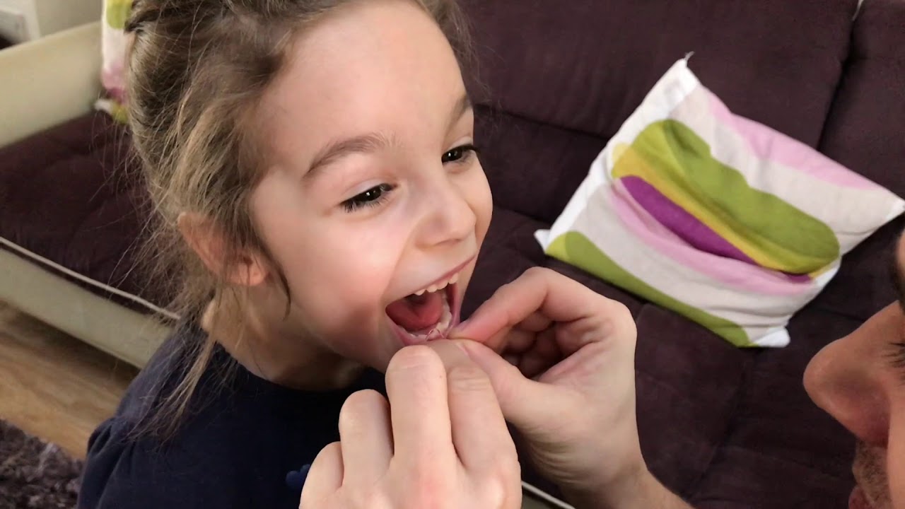 De Mărțisor, Sophia și-a scos un dinte/ On 1th of March, she lost a tooth!