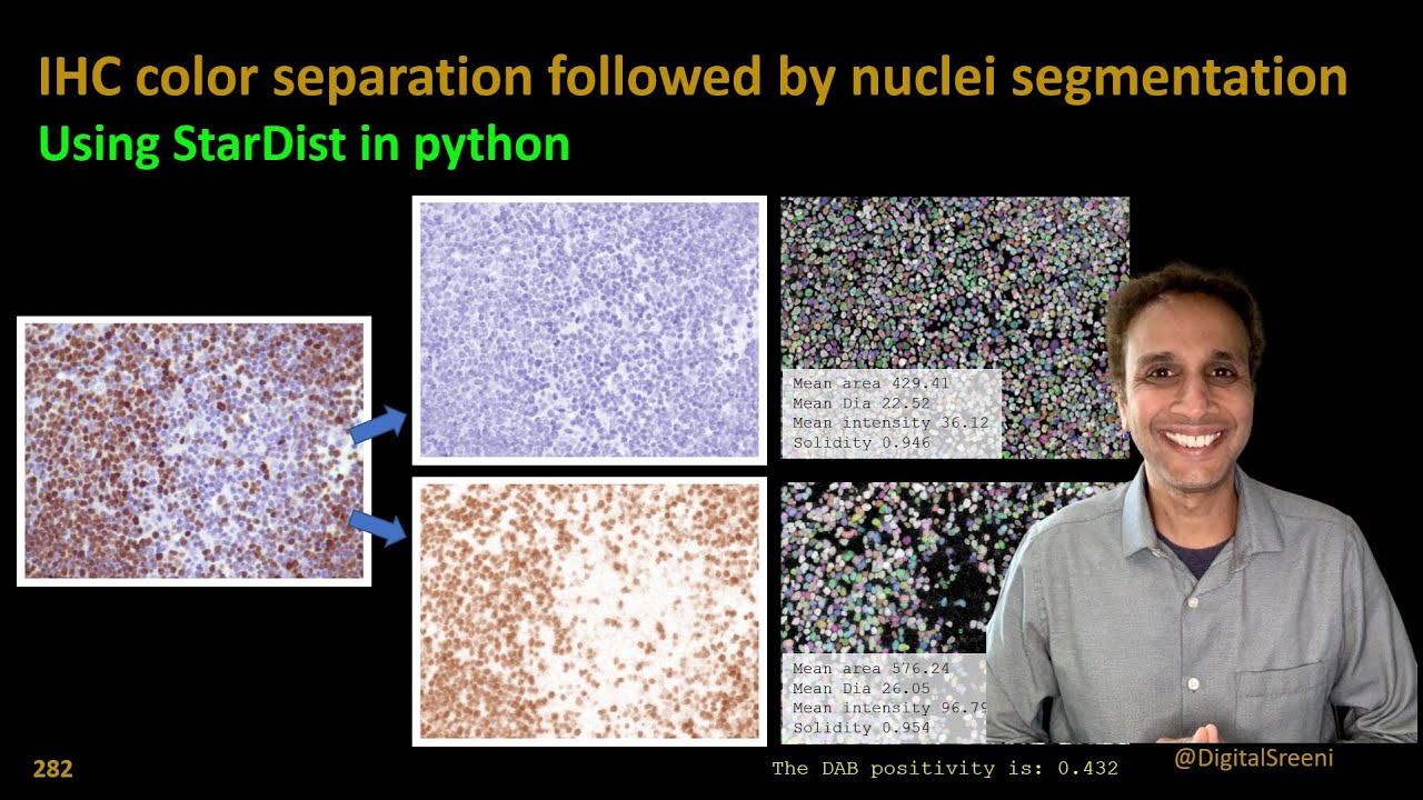 282 -  IHC color separation followed by nuclei segmentation using StarDist in python