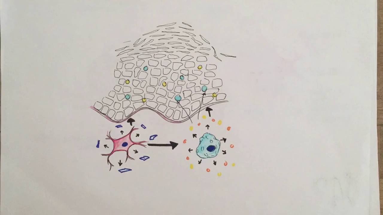 Psoriasis Animation