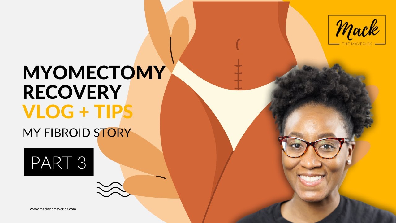 What To Expect After Myomectomy| Week by Week Recovery Vlog and Tips (TIMESTAMPED)