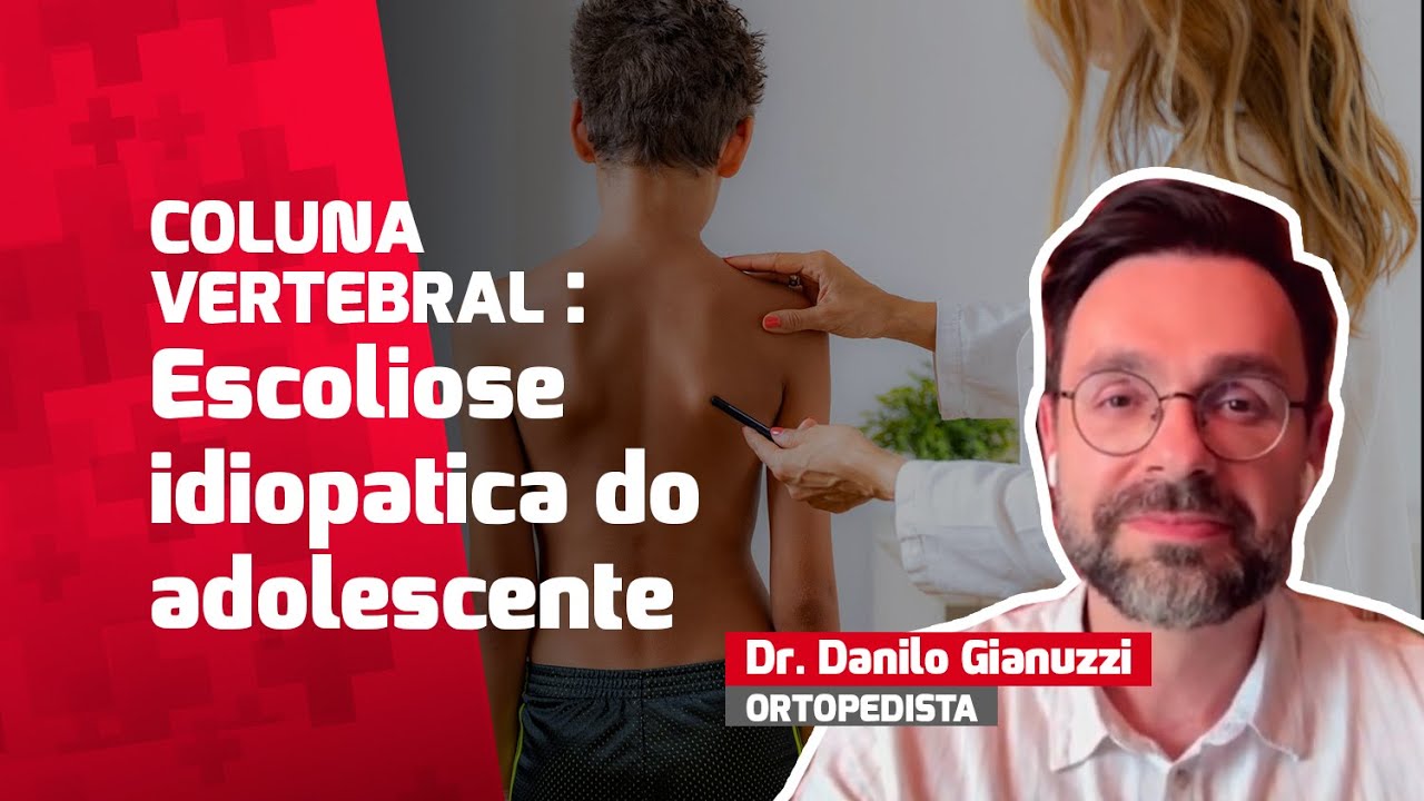 Escoliose idiopática do adolescente: o que pais e jovens precisam saber