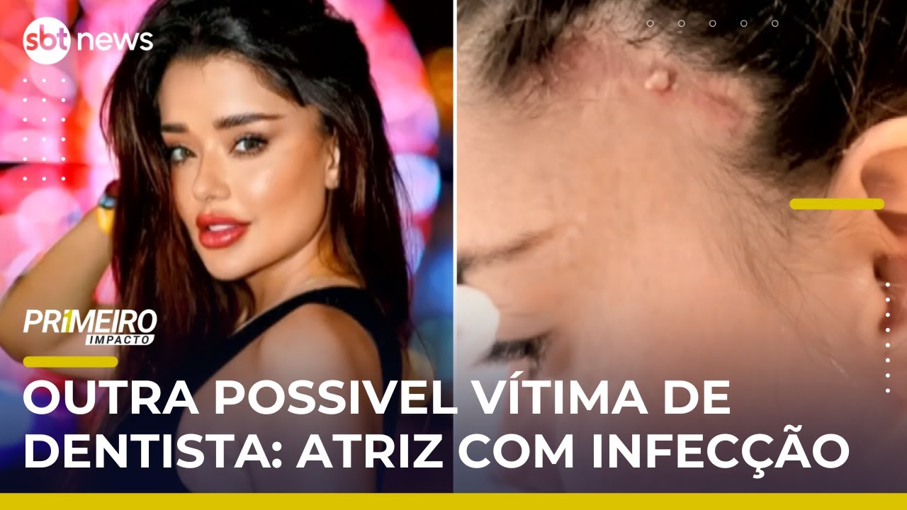 Dentista é investigado após morte de influenciador e complicações em atriz | #PrimeiroImpacto