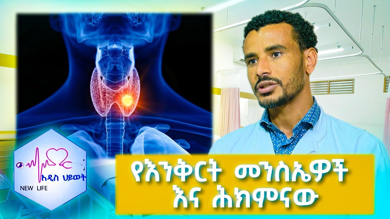 የእንቅርት መንስኤዎች እና ሕክምው //New Life//