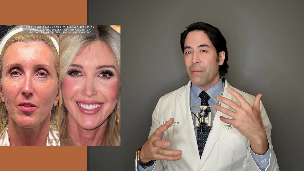 ENDOSCOPIC BROW LIFT