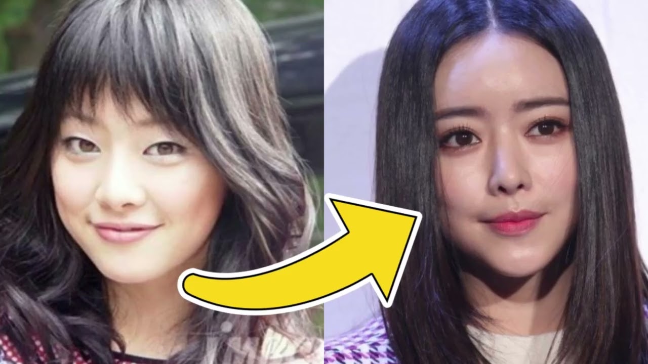 Top 10 Korean Actresses With Plastic Surgery 2024