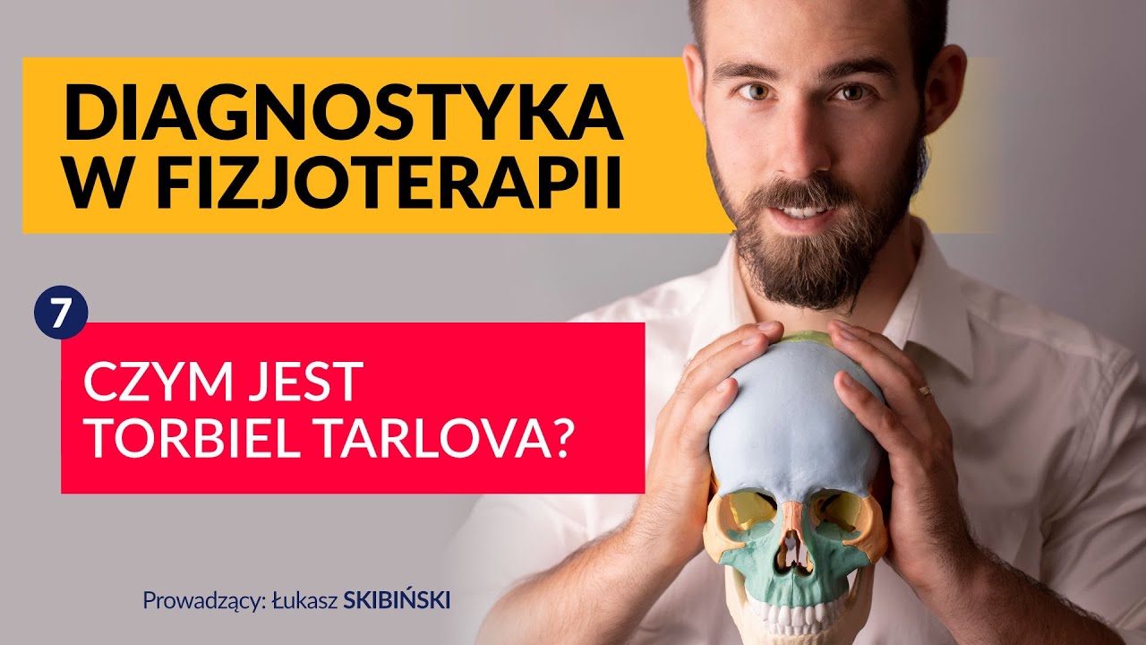 Czy jest torbiel Tarlova. Diagnostyka w fizjoterapii. Odcinek 7