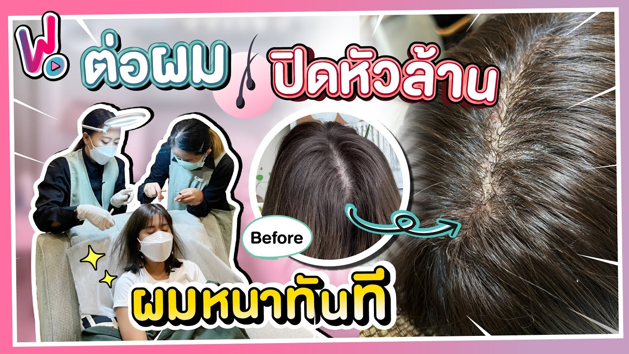 รีวิวพลีชีพ I แก้ผมบางกลางหัว ด้วยเทคนิคต่อผม 600 เส้น !! [Wonderful X Thebeautybar]
