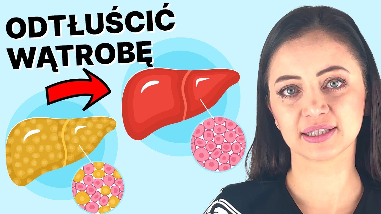 Jak odwrócić stłuszczenie wątroby: 11 sposobów na tłuszcz w wątrobie | dr Angelika Kargulewicz
